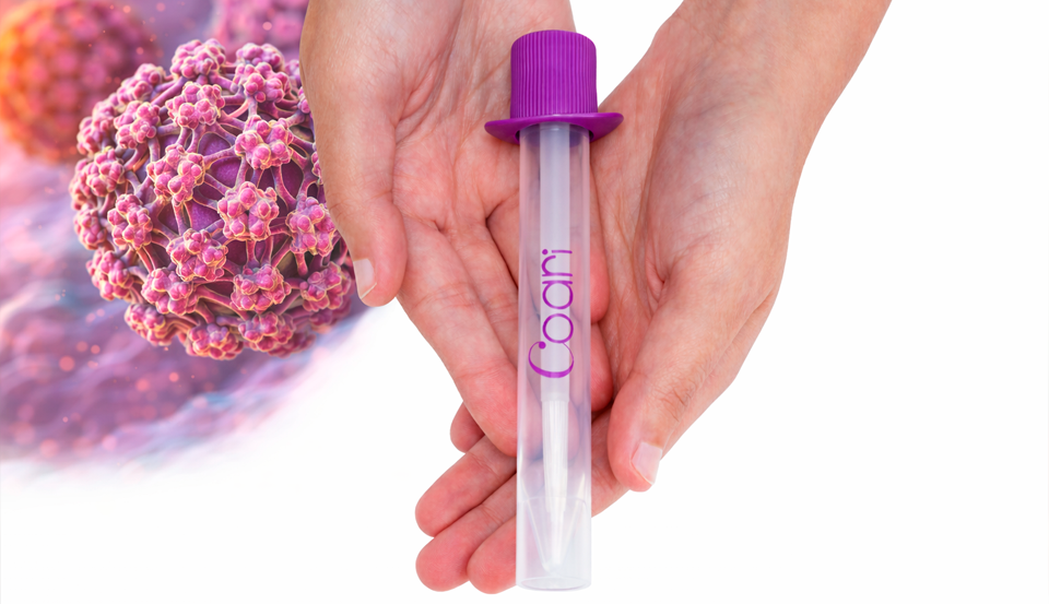 Laboratório Bom Pastor amplia a prevenção ao câncer de colo do útero com exame de HPV por autocoleta